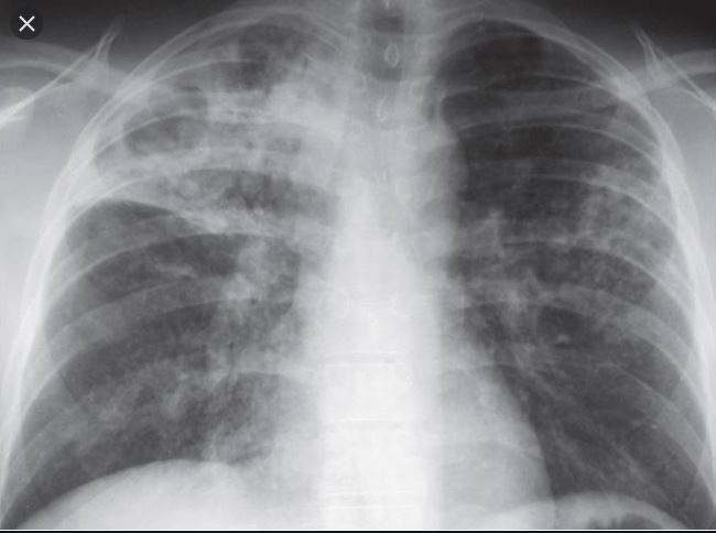 Case 15